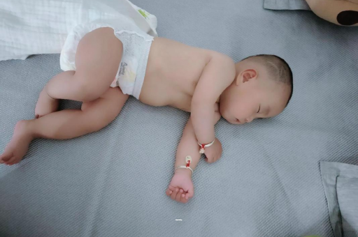 广州借卵试管代怀包男孩宝宝脸上有白色斑块 广州借卵试管代怀包男孩宝宝脸上有白色斑块